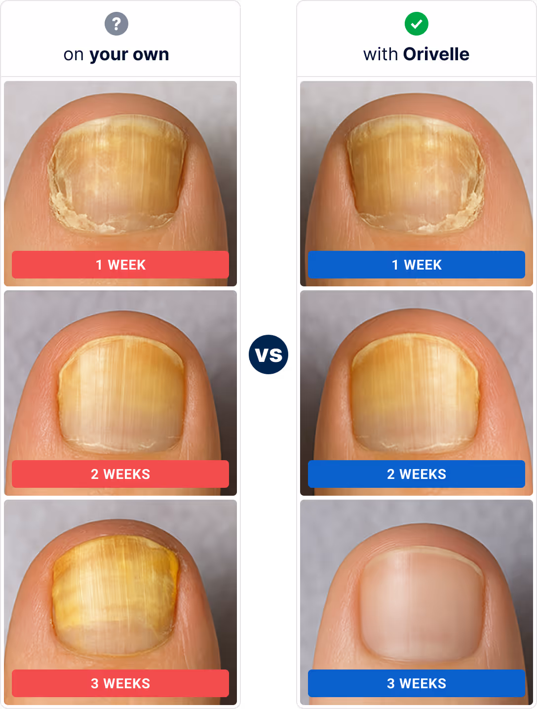 Comparison